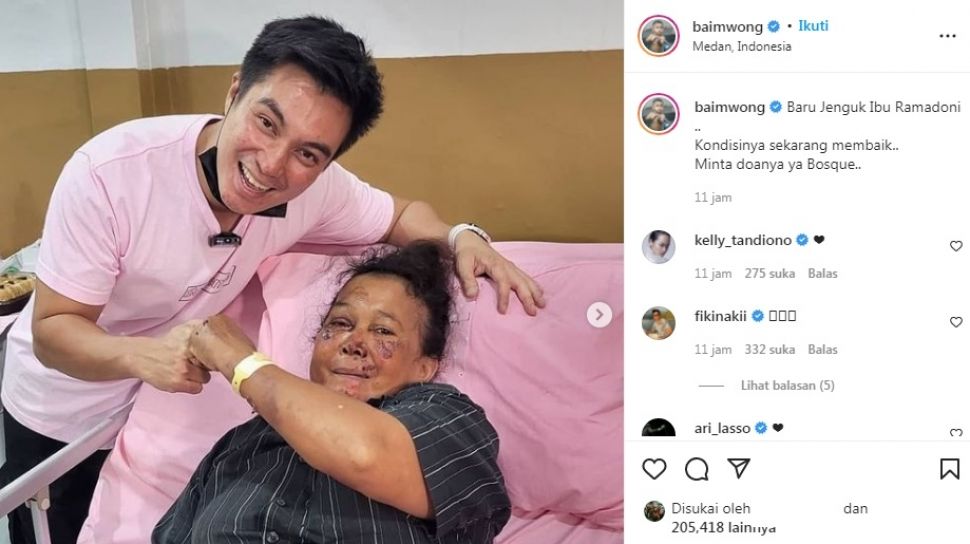 Kaca Lampu Depan Vario 150 Medan. Ibu Korban Begal di Medan Dapat Surprise dari Baim Wong, Honda Genio Baru Diberikan Gratis