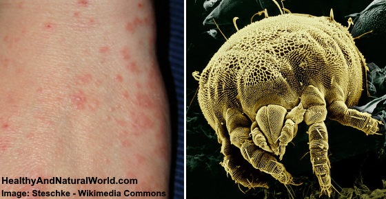 Cara Menutup Jok Motor Vario 150. Can Dust Mites Bite Humans 9 Images